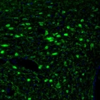 Immunofluorescence staining of mouse hypothalamus shows immunoreactivity in neurons of the paraventricular nucleus.