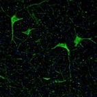 Immunofluorescence staining of mouse medulla shows positivity in the gigantocellular reticular nucleus neurons.