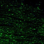 Immunofluorescence staining of mouse hindbrain shows cytoplasmic immunoreactivity in neurons of the pontine nucleus.