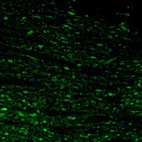 Immunofluorescence staining of mouse hindbrain shows cytoplasmic immunoreactivity in neurons of the pontine nucleus.
