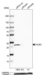 Western blot analysis in U2OS cells transfected with control siRNA, target specific siRNA probe #1 and #2, using Anti-CALB2 antibody. Remaining relative intensity is presented. Loading control: Anti-PPIB.