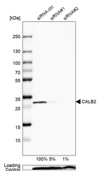 Western blot analysis in U2OS cells transfected with control siRNA, target specific siRNA probe #1 and #2, using Anti-CALB2 antibody. Remaining relative intensity is presented. Loading control: Anti-PPIB.