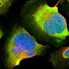 Immunofluorescent staining of human cell line U-2 OS shows localization to cytosol.