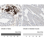 Anti-CALB2 Antibody