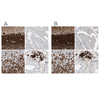 Anti-CALB2 Antibody