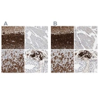 Immunohistochemical staining of human cerebellum, skeletal muscle, stomach and testis using Anti-CALB2 antibody HPA007306 (A) shows similar protein distribution across tissues to independent antibody HPA007305 (B).