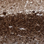 Immunohistochemical staining of human cerebellum shows strong cytoplasmic and nuclear positivity in cells in granular layer.