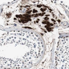 Immunohistochemical staining of human testis shows strong cytoplasmic and nuclear positivity in Leydig cells.