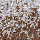 Anti-CALB2 Antibody