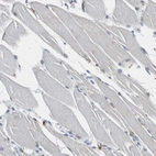 Immunohistochemical staining of human skeletal muscle shows no positivity in myocytes as expected.