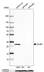 Western blot analysis in U2OS cells transfected with control siRNA, target specific siRNA probe #1 and #2, using Anti-CALB2 antibody. Remaining relative intensity is presented. Loading control: Anti-PPIB.