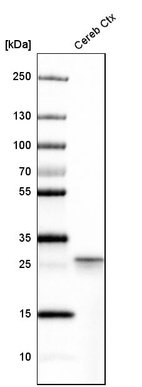 Western blot analysis in human cerebral cortex tissue.