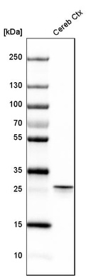 Western blot analysis in mouse cerebral cortex tissue.