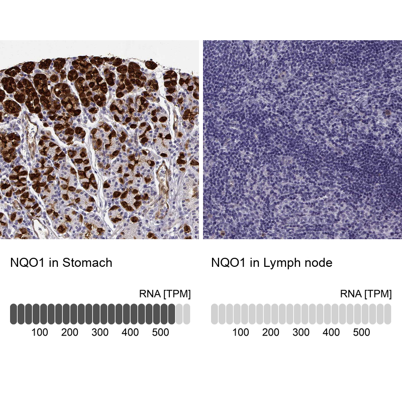 Anti-NQO1 Antibody