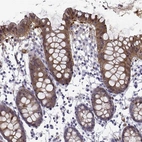 Immunohistochemical staining of human colon shows strong cytoplasmic positivity in glandular cells.