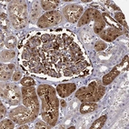 Immunohistochemical staining of human kidney shows strong cytoplasmic positivity in cells in tubules.