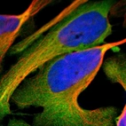 Immunofluorescent staining of human cell line U-2 OS shows localization to cytosol.