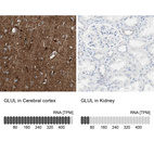 Anti-GLUL Antibody