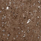 Immunohistochemical staining of human cerebral cortex shows strong cytoplasmic positivity in glial cells.