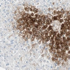 Immunohistochemical staining of human liver shows strong cytoplasmic positivity in hepatocytes.