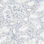 Immunohistochemical staining of human kidney shows only very weak cytoplasmic positivity in a subset of cells in tubules.