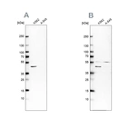 Western blot analysis using Anti-GLUL antibody HPA007316 (A) shows similar pattern to independent antibody HPA007571 (B).
