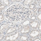Immunohistochemical staining of human kidney shows low positivity in cells in tubules as expected.