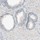 Immunohistochemical staining of human prostate shows low positivity in glandular cells as expected.