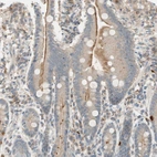 Immunohistochemical staining of human duodenum shows moderate positivity in apical membrane in glandular cells.