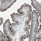 Immunohistochemical staining of human Fallopian tube shows strong positivity in cilia in glandular cells.