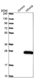 Western blot analysis in control (vector only transfected HEK293T lysate) and MS4A8 over-expression lysate (Co-expressed with a C-terminal myc-DDK tag (~3.1 kDa) in mammalian HEK293T cells, LY403116).