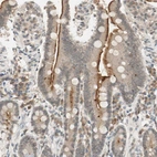 Immunohistochemical staining of human duodenum shows moderate positivity in apical membrane in glandular cells.