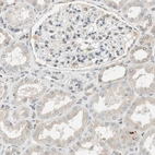 Immunohistochemical staining of human kidney shows low positivity in cells in tubules as expected.