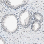 Immunohistochemical staining of human prostate shows low positivity in glandular cells as expected.