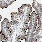 Immunohistochemical staining of human Fallopian tube shows strong positivity in cilia in glandular cells.
