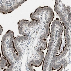 Immunohistochemical staining of human Fallopian tube shows strong positivity in cilia in glandular cells.