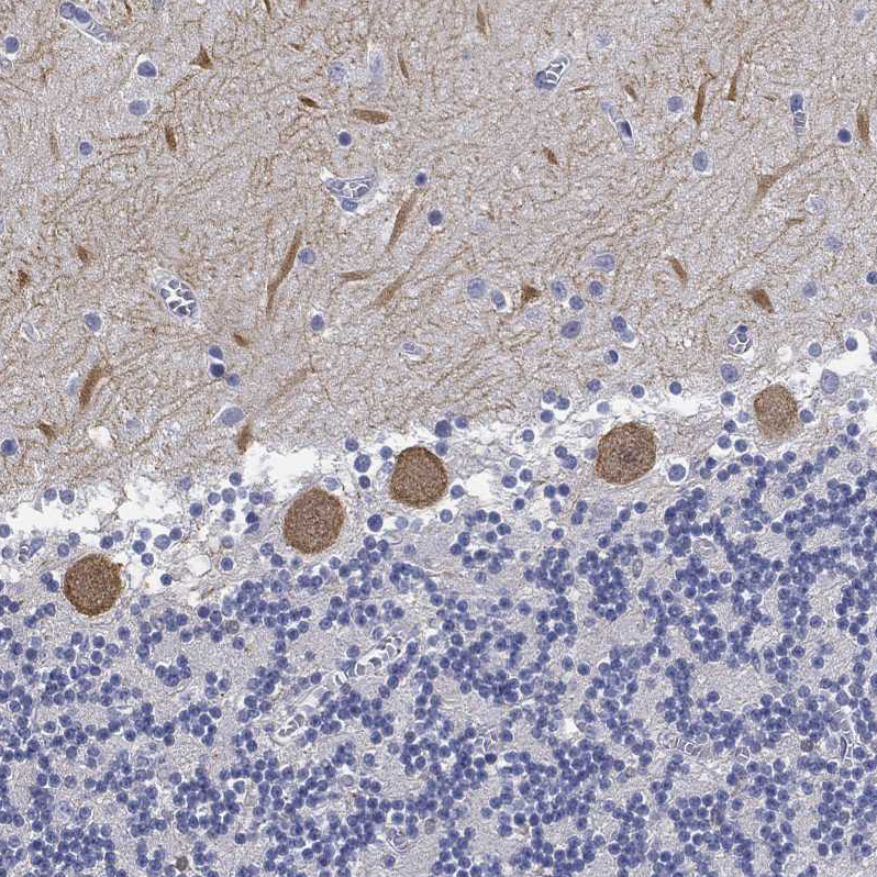 Anti-GPR61 Antibody
