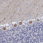 Anti-GPR61 Antibody