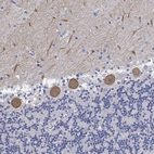 Anti-GPR61 Antibody