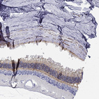 Immunohistochemical staining of human eye, retina shows moderate positivity in photoreceptor cell segments and outer plexiform layer.