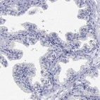 Immunohistochemical staining of human prostate shows no positivity in glandular cells as expected.