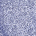 Immunohistochemical staining of human tonsil shows no positivity in germinal center cells as expected.