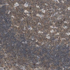 Immunohistochemical staining of human lymph node shows high expression.