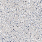 Immunohistochemical staining of human liver shows low expression as expected.