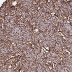 Anti-RBP1 Antibody