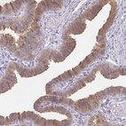 Immunohistochemical staining of human fallopian tube shows moderate cytoplasmic positivity in glandular cells.