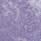 Immunohistochemical staining of human tonsil shows no positivity in non-germinal center cells as expected.