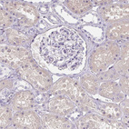 Immunohistochemical staining of human kidney shows no positivity in cells in glomeruli as expected.
