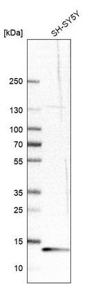 Anti-RBP1 Antibody