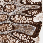 Anti-GALE Antibody